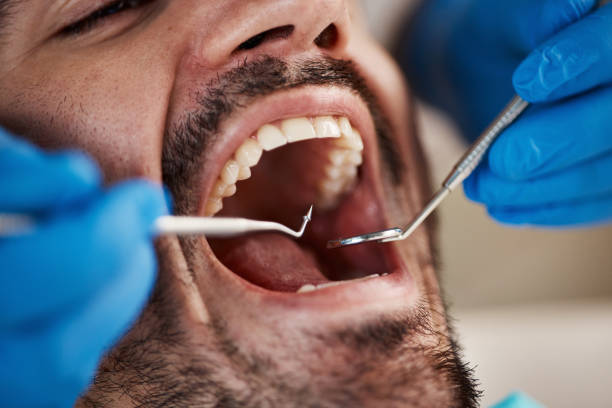 Best Broken or Cracked Tooth Emergency Dentist in Indian Head, MD
