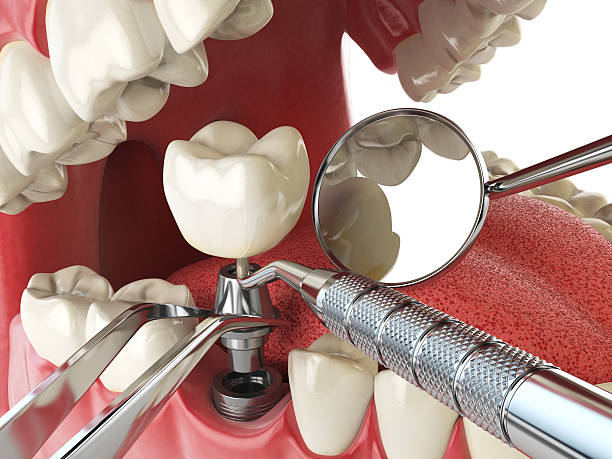  Indian Head, MD Emergency Dentist Pros